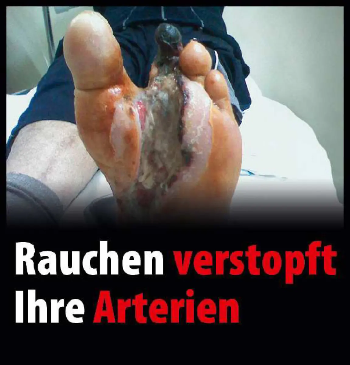 Arterien