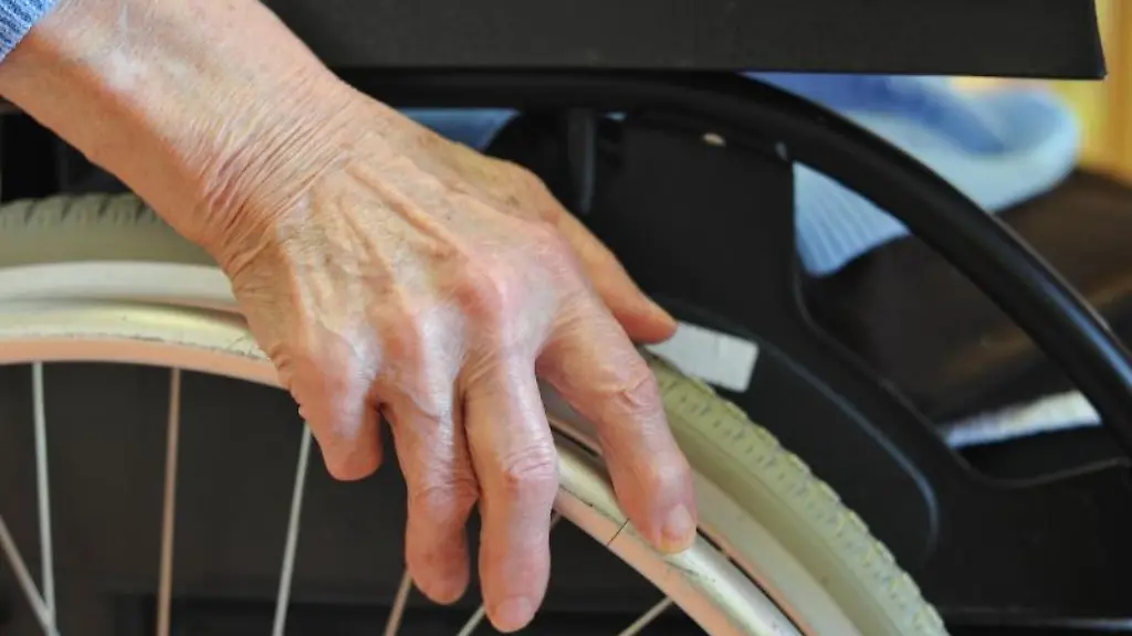 Gefuehlsstoerungen-Laehmungen-Kraftlosigkeit-Bei-den-meisten-Menschen-mit-Multipler-Sklerose-geht-der-in-den-Anfangsjahren-schubfoermige-Verlauf-irgendwann-in-eine-dauerhaft-fortschreitende-Form-ueber