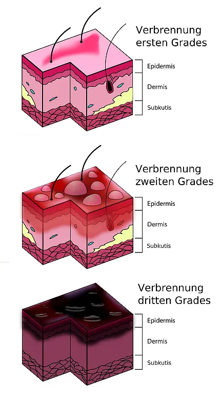 Verbrennung-Persian-Poet-Gal-CC-BY-SA-3