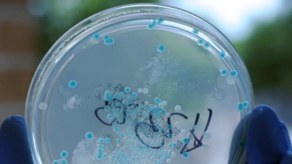 In-den-USA-werden-jaehrlich-hoechstens-500-Elizabethkingia-Infektionen-registriert