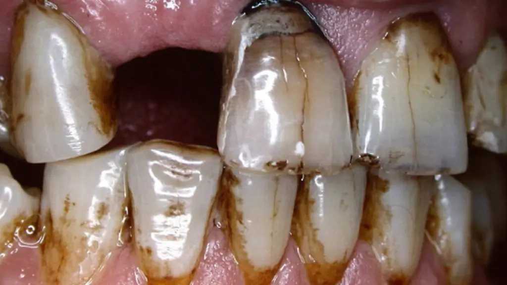 66fe5507da4a6f3e806dde19a0ccd5ec