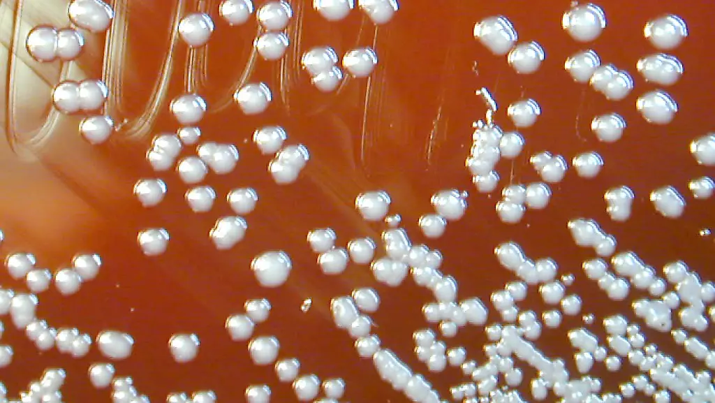 Burkholderia-pseudomallei-01