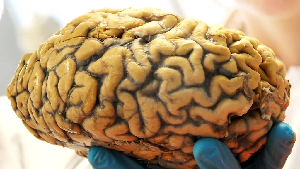 7aaded1aa202a38b95b96da543f79660