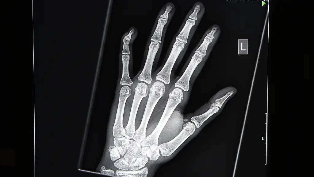 3qix3223-jpg1627371561454169525