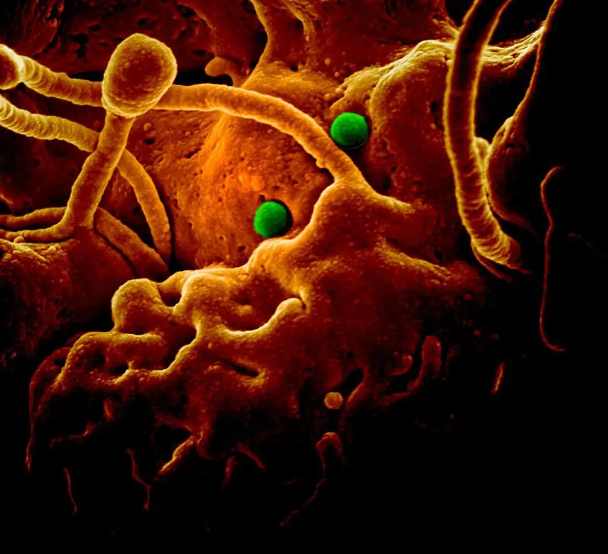 MERS-Coronavirus-Particles-14855805237