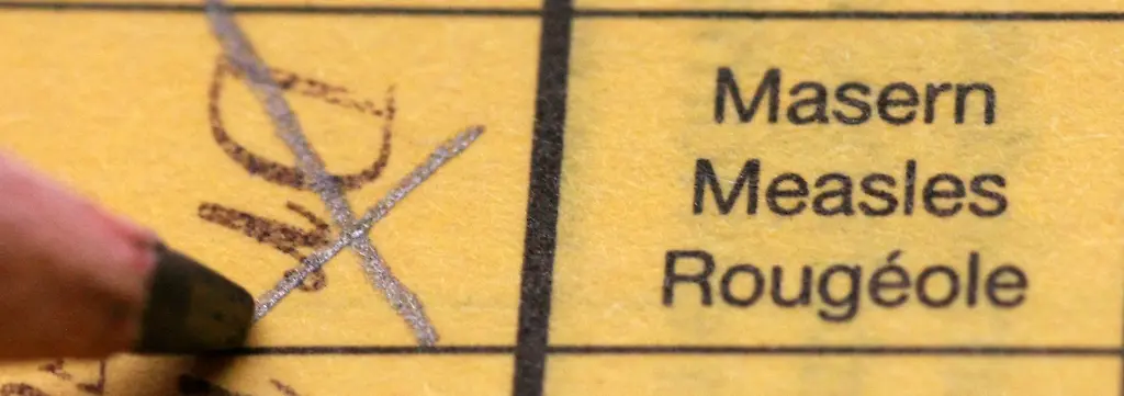 Bild zum Thema Masern