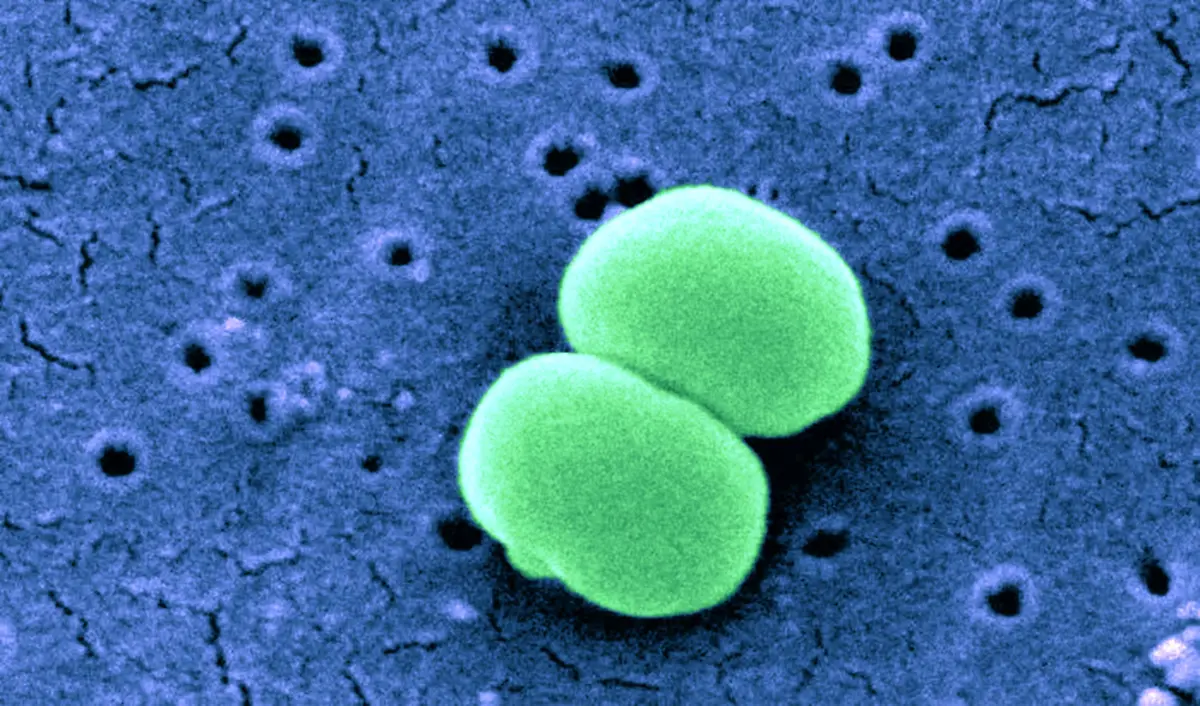 Staphylococcus-epidermidis