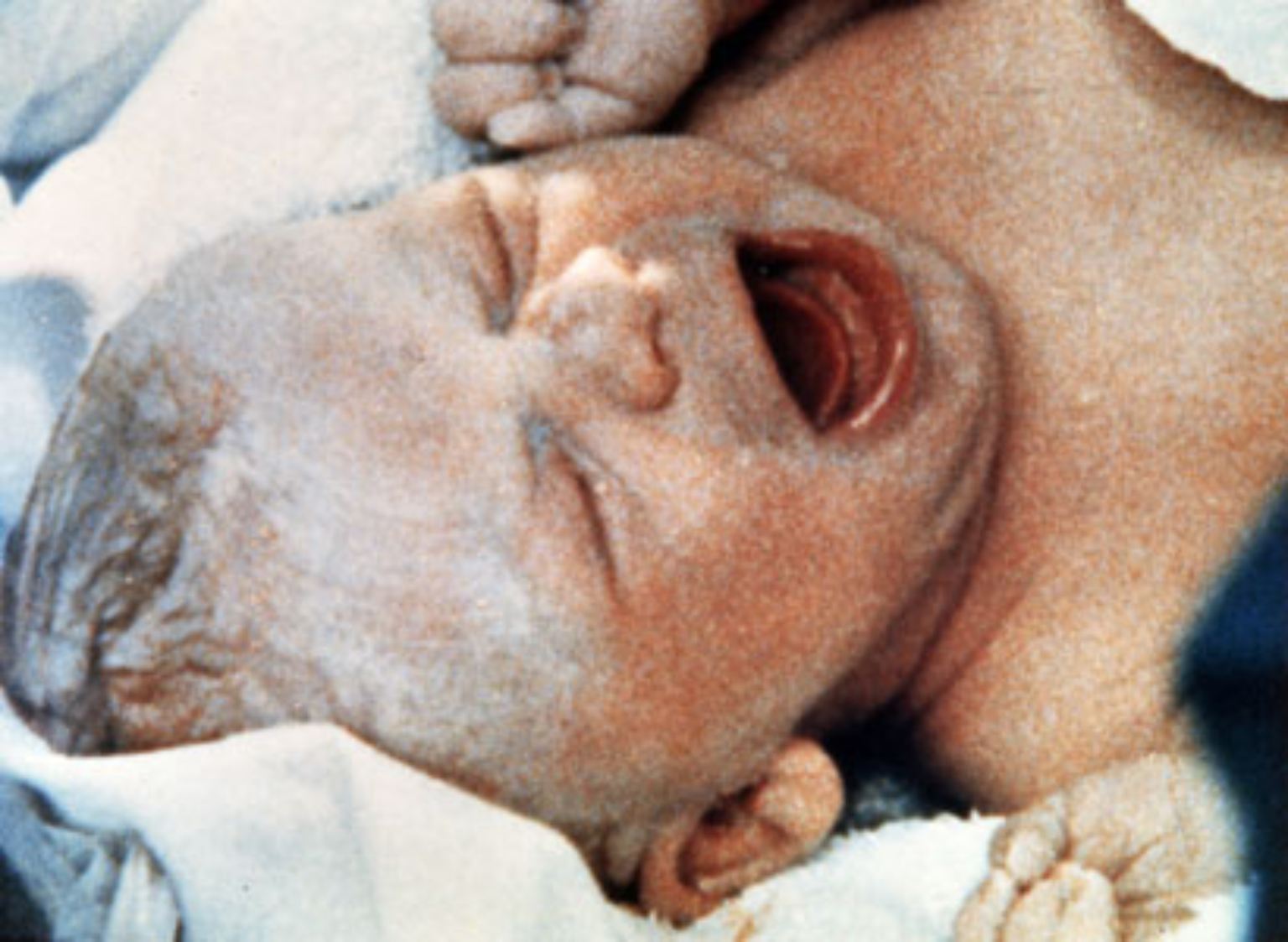Als britische Wissenschaftler vor drei Jahrzehnten das erste Retortenbaby der Welt "erschufen", hielt die Welt den Atem an.