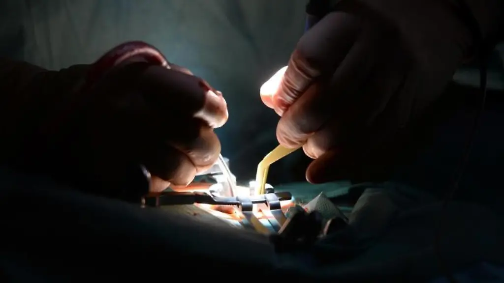 Tausende-Patienten-glauben-dass-bei-ihrer-OP-etwas-schiefgelaufen-ist