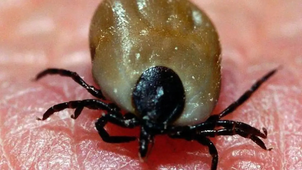 Zeckenbisse-koennen-gefaehrlich-werden-Vor-einer-FSME-schuetzt-eine-Dreifachimpfung