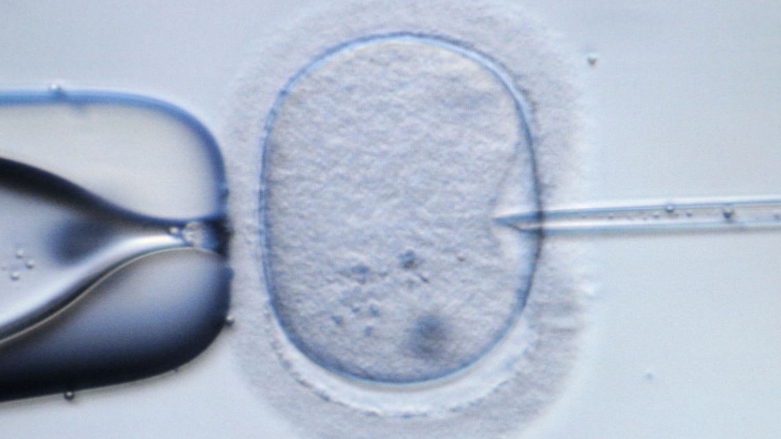 Mikroskopische Aufnahme einer menschlichen Eizelle, die injiziert wird
