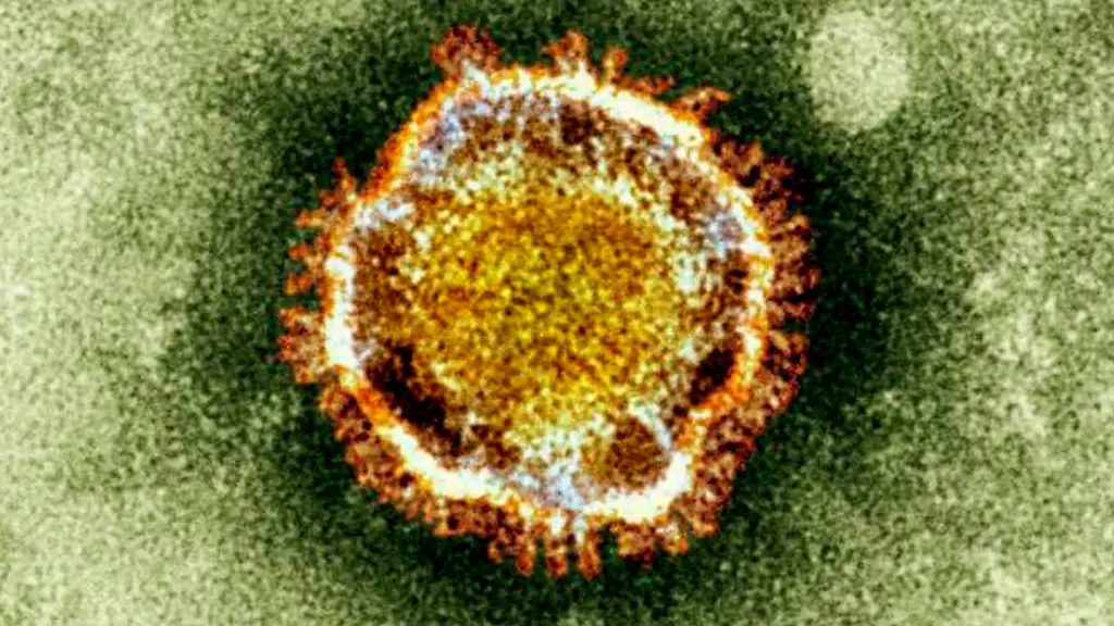 32855A0016643E70-jpg4912595217283761499