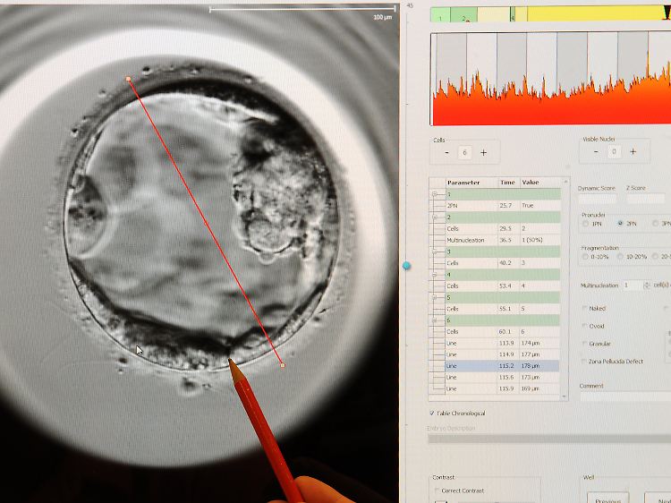 Im Kinderwunschzentrum Leipzig ist ein mit einem EmbryoScope aufgenommener fünf Tage alter Embryo zu sehen.