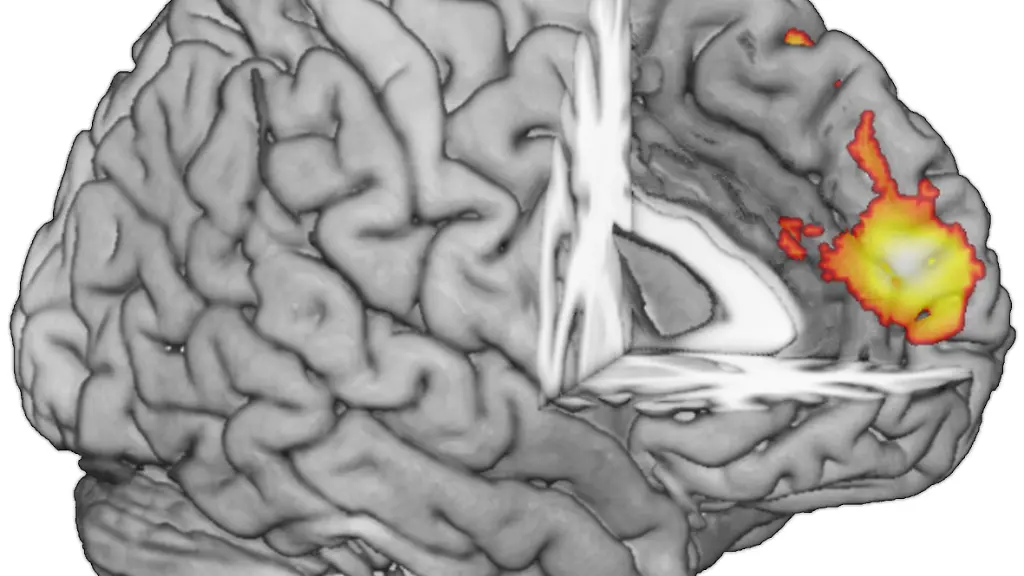 13-03-20hirnareale-jpg-jsessionid-AB8FAF33EF0FEE4C1B6AF234D2CD0E7A