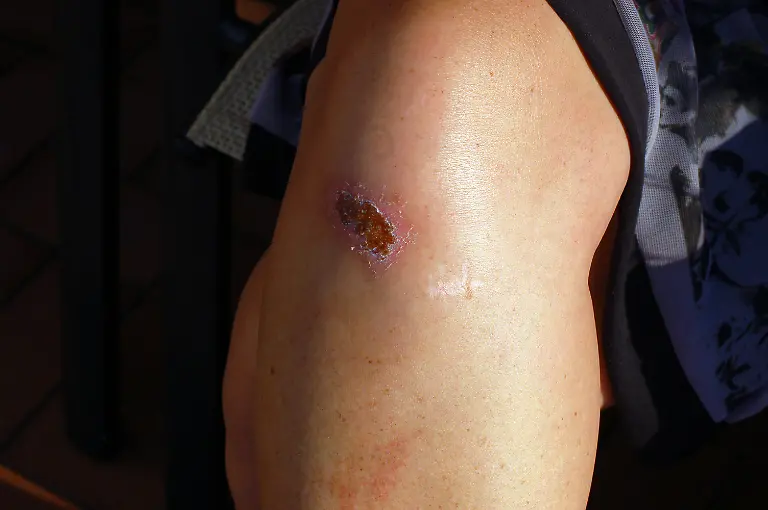 2010-07-10-gdansk-by-RalfR-086