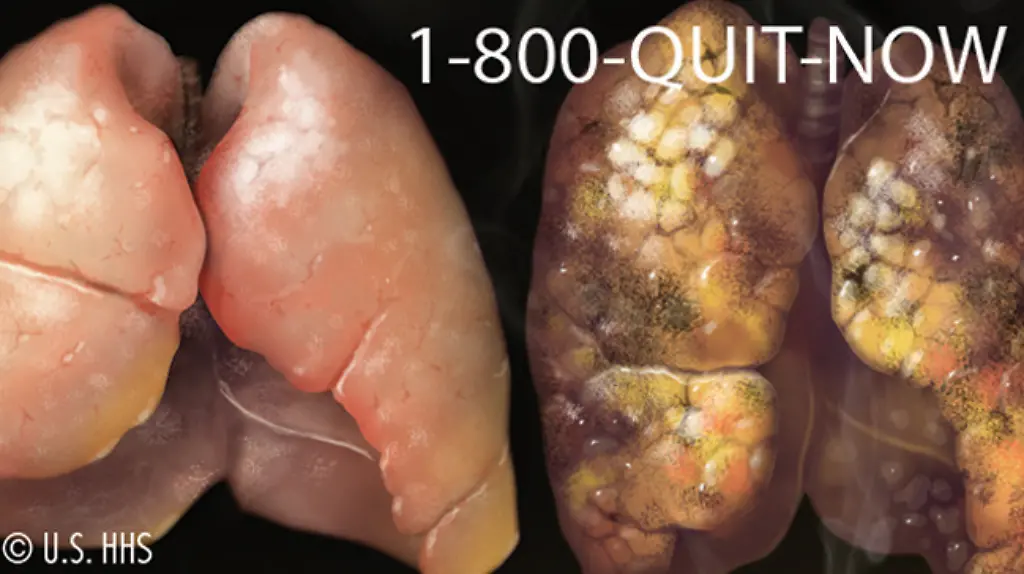 38vp0549-jpg7751490138138269748