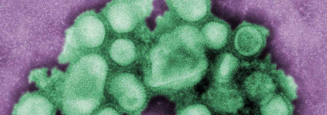 Der Schweinegrippevirus in mikroskopischer Aufnahme.
