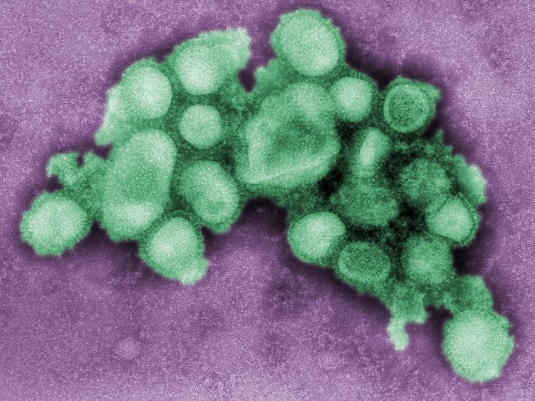 Das Schweinegrippevirus, aufgenommen von der US-Seuchenkontrollbehörde CDC.