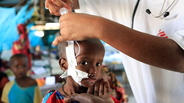 Diesem einjährigen Mädchen wird im "Ärzte ohne Grenzen"-Krankenhaus in Dadaab eine Magensonde gelegt.  