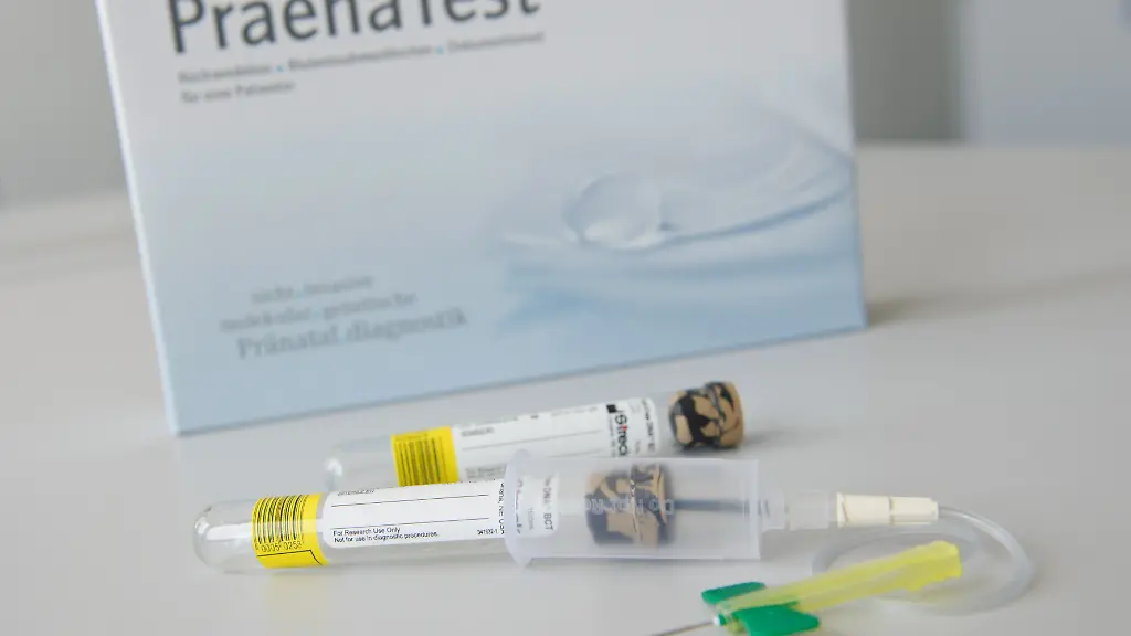 Der-PraenaTest-ist-ein-einfacher-Bluttest