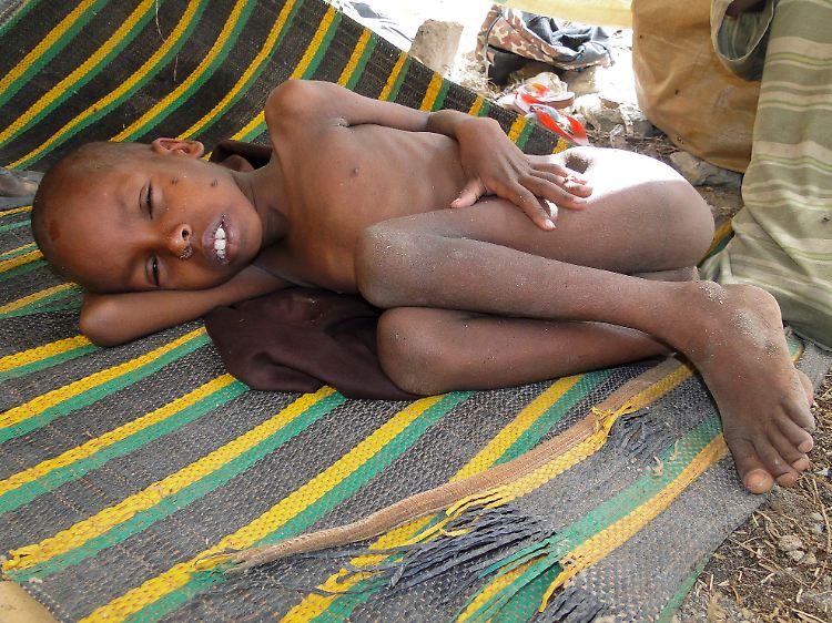 Ein ausgezehrter Junge, der mit seiner Familie vor der Dürre im Süden Somalias geflohen ist, hat Mogadischu erreicht.