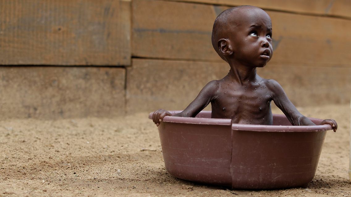 Wenn die Bilder aus der Presse verschwinden, wird die Welt das Elend in Afrika wieder vergessen.
