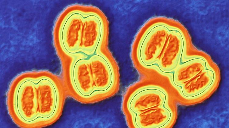 Meningokokken sind häufig die Erreger, die zu einer Meningitis führen.