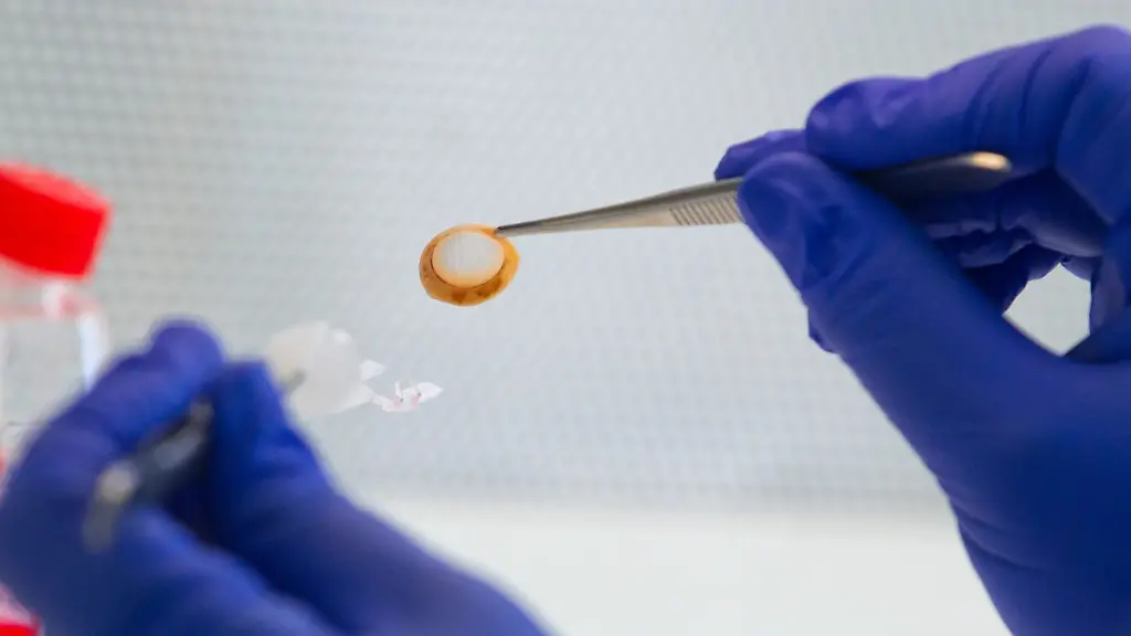 34wt0340-jpg4989650527243922522