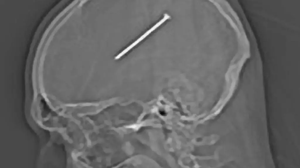 DAB0178-20120121-jpg2841007003980813897