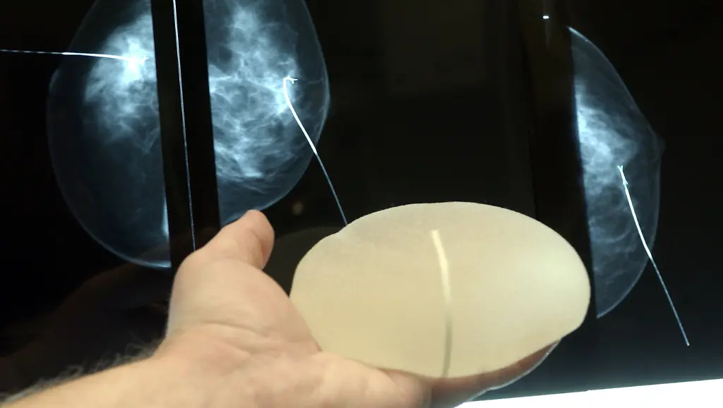 32293549-jpg5723659310457328573