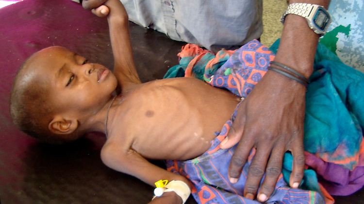 Vor allem Kinder leiden unter der Dürrekatastrophe - und unter der Gewalt in Somalia.