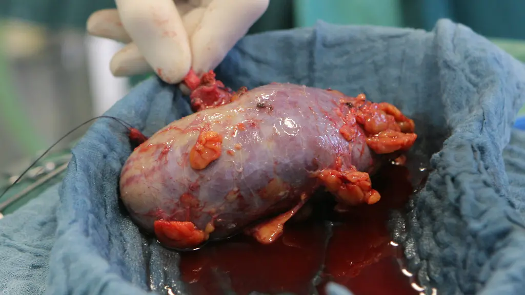 2yho0100-jpg8211355440534680016