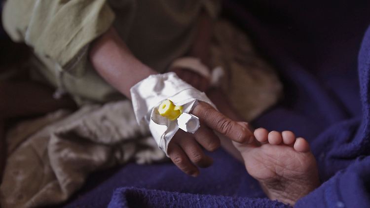 Fuß und Hand eines unterernährten Kindes in einem Feldlazarett des Internationalen Roten Kreuzes im kenianischen Dadaab.