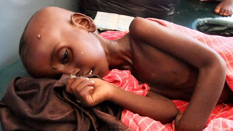 Farhiya Abdulkadir ist fünf Jahre alt. Der somalische Junge leidet an Unterernährung und wird in einem Hospital in Mogadischu behandelt.