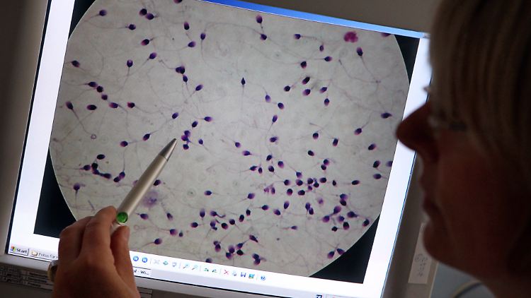 Ein Spermiogramm: Den Männern wird mit der Antibabyspritze Testosteron gespritzt - die Hoden stellen das Hormon nicht mehr her, wenn es von außen kommt.