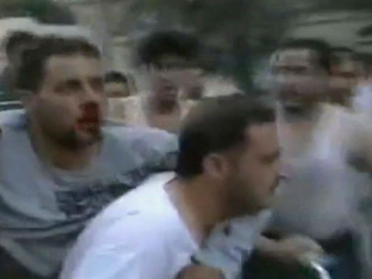 Die Bilder aus Syrien sind rar. Hier ein Verletzter aus Hama in einem Amateurvideo vom 31. Juli.
