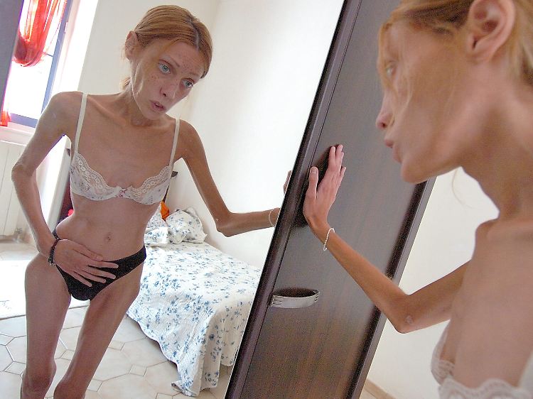 Stars haben meistens eine schlechte Vorbildfunktion. Das französische Model Isabelle Caro starb 2010.