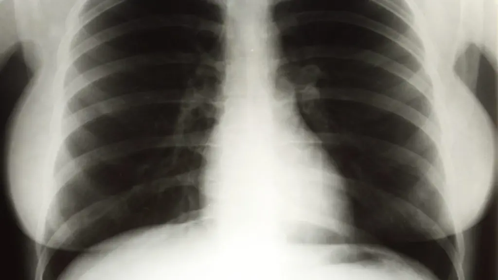 2rto1759-jpg6668623368149701548