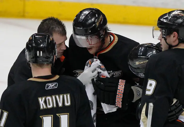 selanne-hurt3