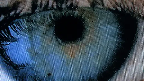 Chip als Augen-"Prothese": Blinde knnen wieder sehen - ntv.de