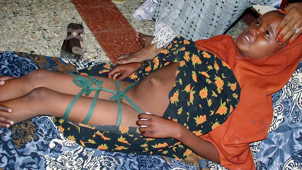 Beschneidung-Somalia