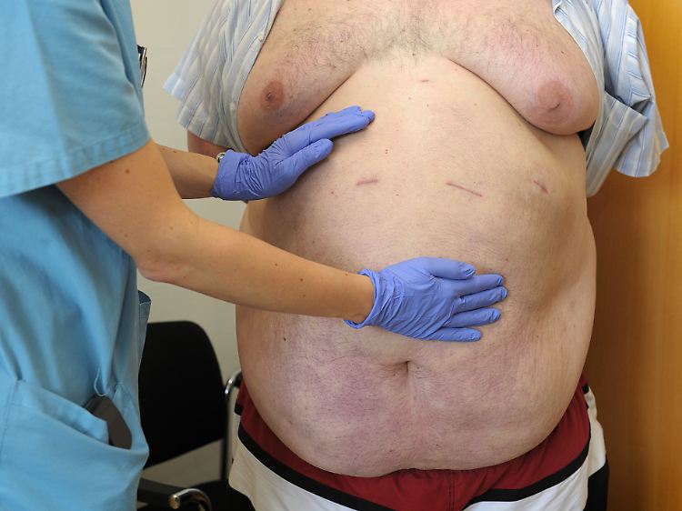Vor allem das Bauchfett steht im Verdacht, für Gefäßverkalkungen und Bluthochdruck verantwortlich zu sein.