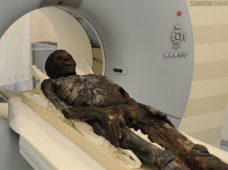 Die dreidimensionalen Körperscans sind so detailreich, dass mit ihren Daten exakte Kunststoffkopien von Körperteilen hergestellt werden könne.