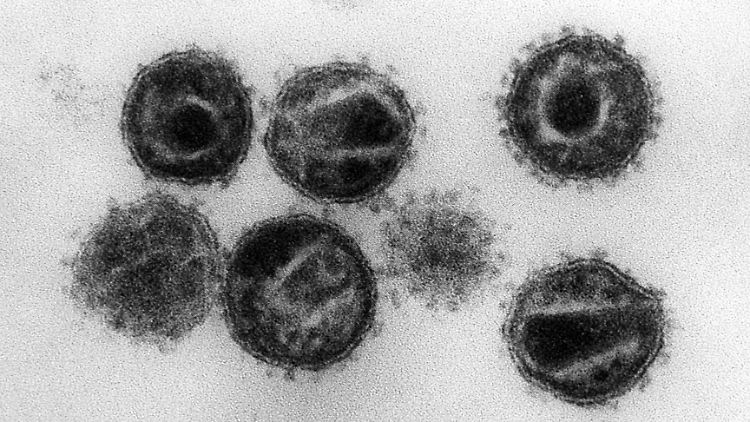 Elektronenmikroskopische Aufnahme mehrerer HIV (Humane Immunschwäche-Viren).