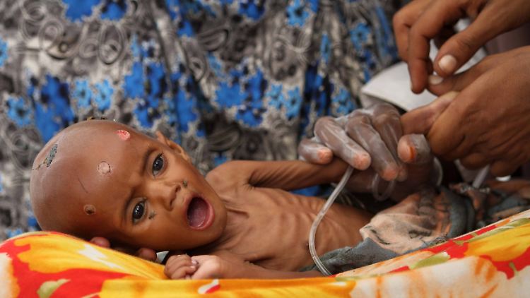 Für viele Kinder aus Somalia kommt jede ärztliche Hilfe zu spät. Hier im Banadir-Krankenhaus von Mogadischu.
