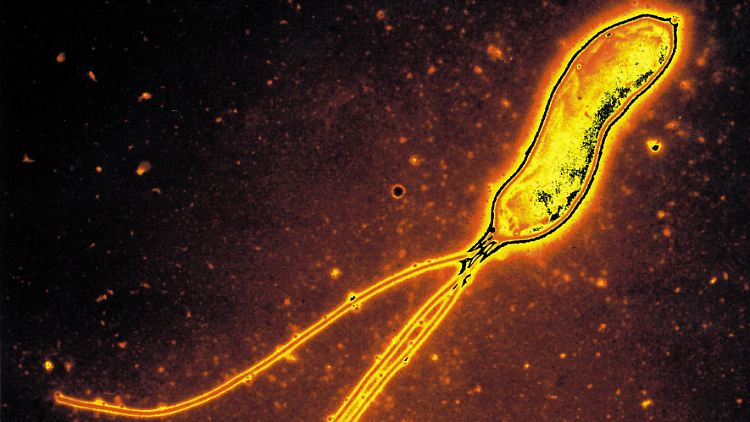 Helicobacter pylori besitzt drei bis sechs Geißeln, um sich fortbewegen zu können.