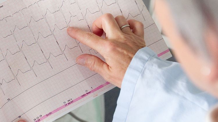Mit einem Elektrokardiogramm (EKG) werden die elektrischen Aktivitäten aller Herzmuskelfasern aufgezeichnet.