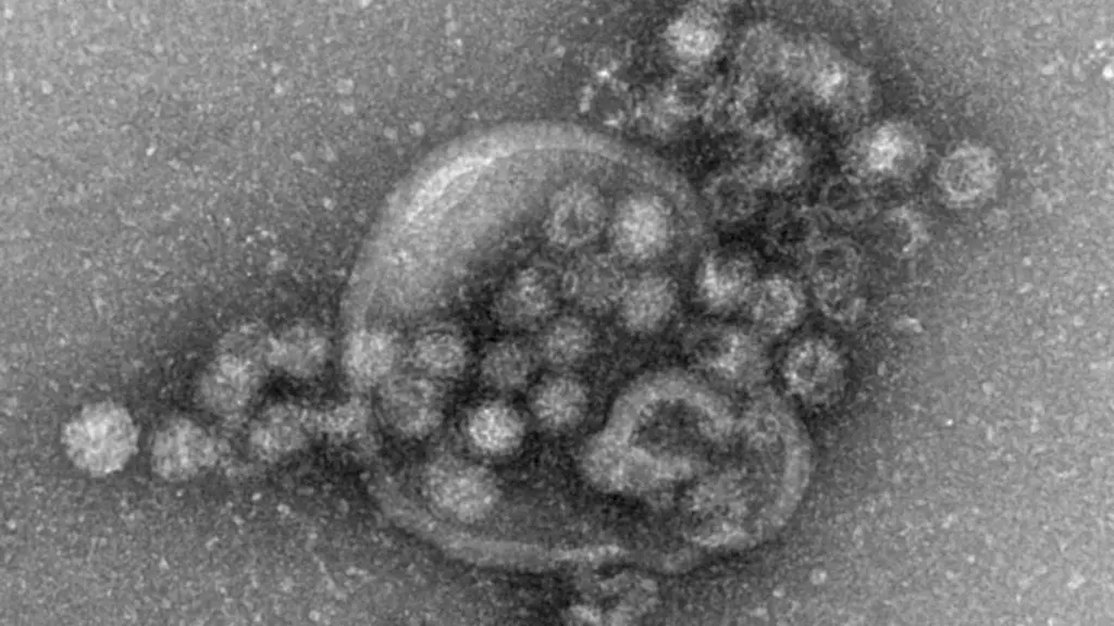 Das-Norovirus-ist-sehr-leicht-uebertragbar-und-gehoert-zu-den-weltweit-haeufigsten-Erregern-fuer-ploetzlich-auftretenden-Brechdurchfall
