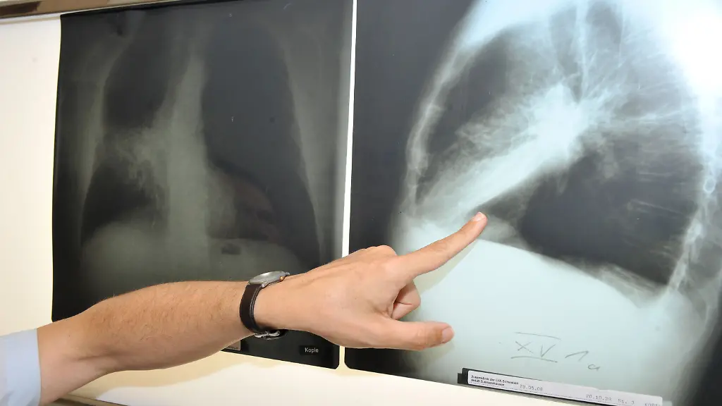 8034cc94aca83508fa0d7177d6ebad34