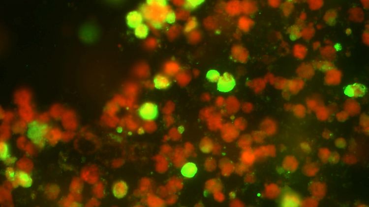 Blick durch ein Mikroskop der Medizinischen Hochschule Hannover: Die "Immunfluorenz-Methode" lässt die Influenza-Viren leuchten. Während gesunde Zellen rot erscheinen, strahlen infizierte Zellen grün.